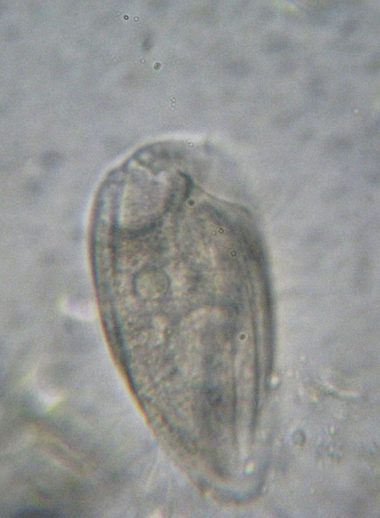 Protozoi del muschio: Phacodinium metchnicoffi ?